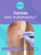 varizes